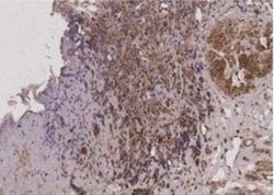 PHF1 Antibody, Novus Biologicals 0.1mL; Unlabeled:Antibodies, Polyclonal
